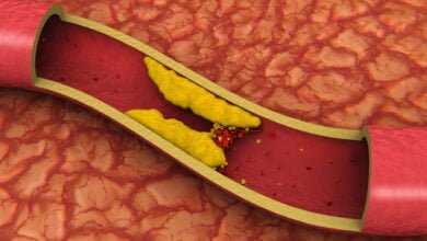 صورة ماذا تعرف عن الكوليسترول