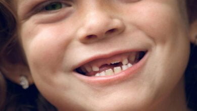 صورة أسنان الأطفال وأهمية العناية بها