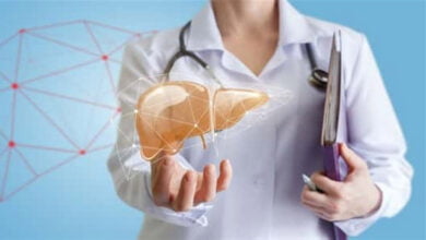 صورة الكبد الدهني وطرق الوقاية منه