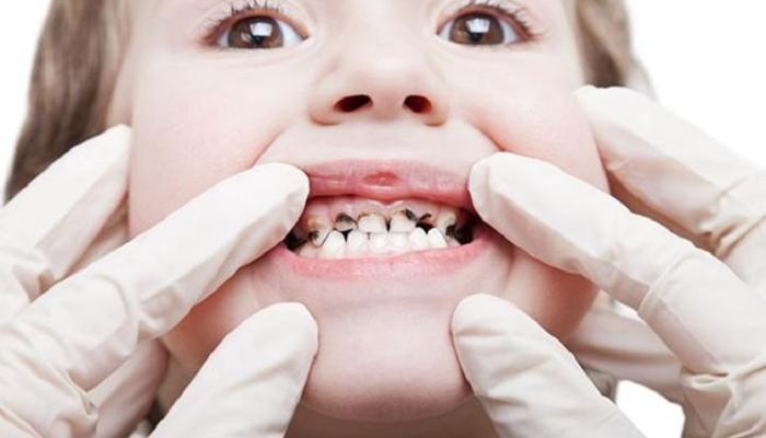 مراجعة طبيب أسنان الأطفال