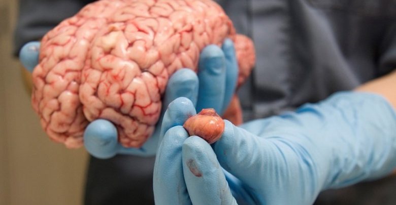 أهم الأعضاء البشرية / الدماغ المتحكم بالجسد
