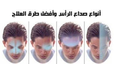 صورة أنواع صداع الرأس وأفضل طرق العلاج