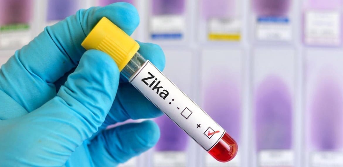 أعراض الإصابة بفيروس زيكا والوقاية منه