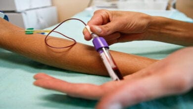 صورة أنواع فقر الدم