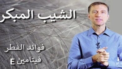 صورة شيب الشعر المبكر ما هو سببه وطرق العلاج