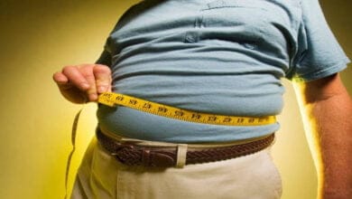 صورة عوامل خطر السمنة