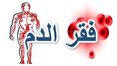 صورة فقر الدم (الأنيميا – Anemia)