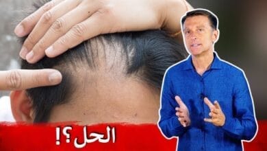 صورة كيف تتجنب تراجع الشعر وعلاجه