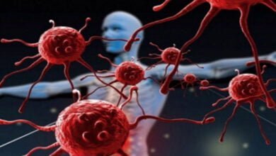 صورة مرض السرطان كيف تتجنب الإصابة به