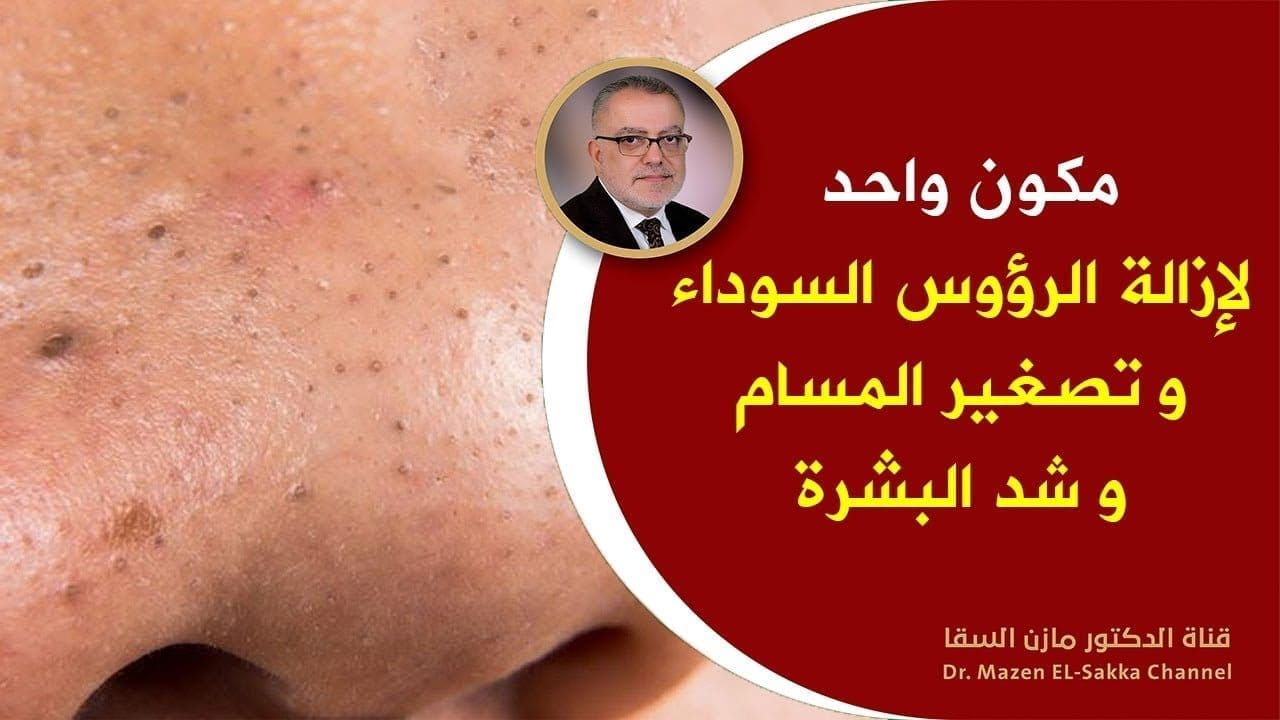 أفضل خلطة لإزالة الرؤوس السوداء