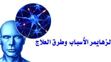 صورة أهم أسباب الزهايمر وطرق العلاج