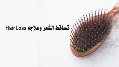 صورة تساقط الشعر وعلاجه Hair Loss