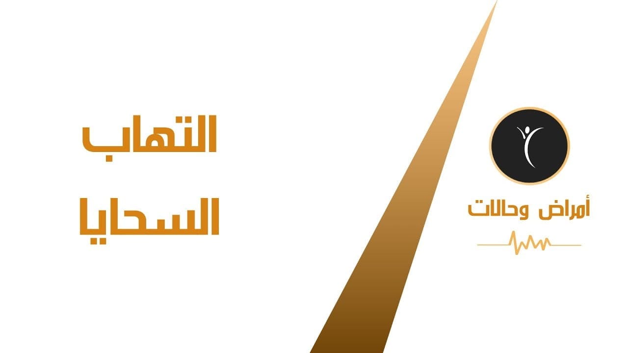 ما هو التهاب السحايا Meningitis وكيفية علاجه