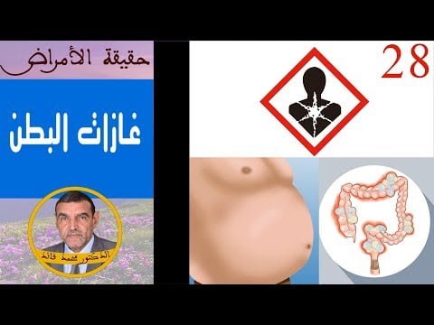 الدكتور محمد فائد- أسباب وحلول غازات البطن