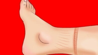 صورة 10 علامات تدل على مشاكل في القلب