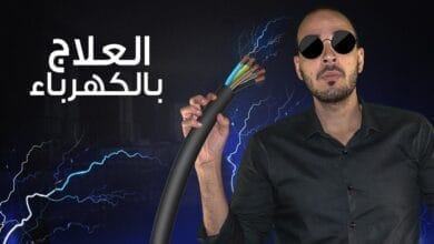 صورة العلاج بالصدمات الكهربائية ECT