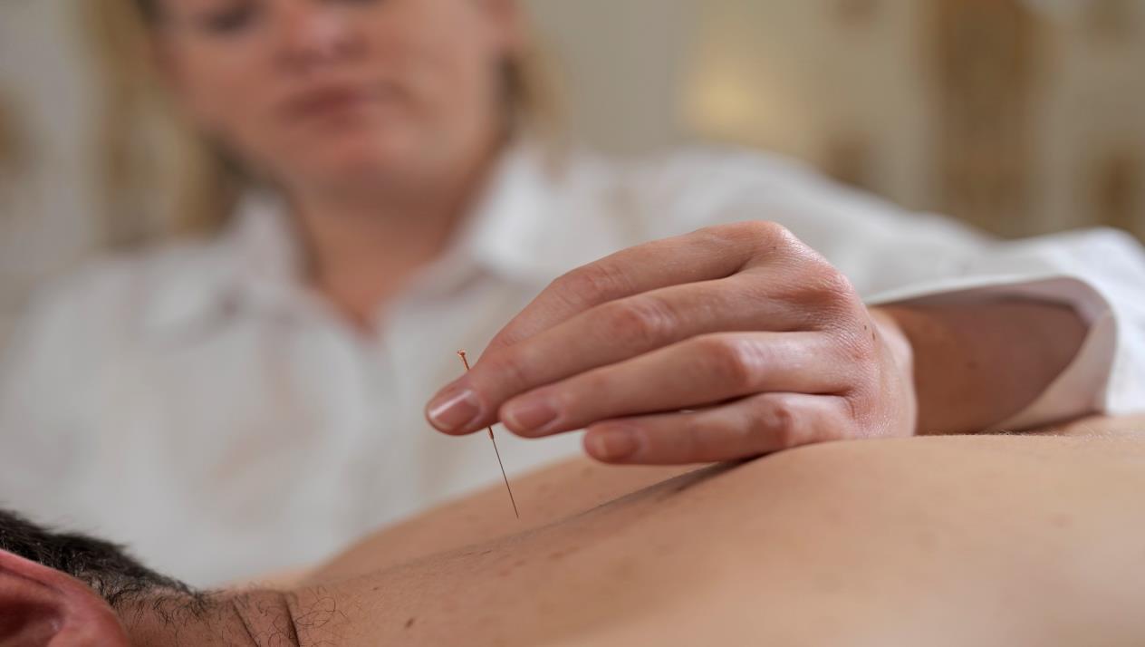 علاج الإبر الصينية مع مصطفى محمود