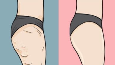 صورة عملية تكسير الدهون