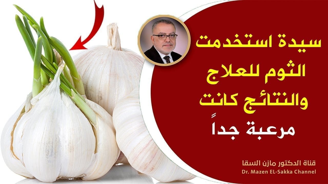 مخاطر الإفراط في تناول الثوم