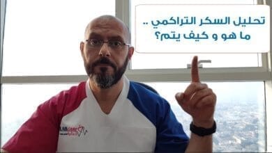 صورة إجراء تحليل السكر التراكمي لمرضى السكر