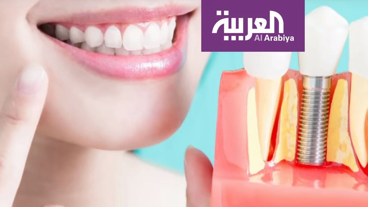 زراعة الأسنان والتقنيات الجديدة