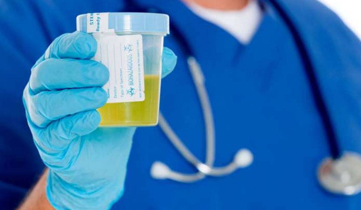 قراءة نتائج تحليل البول