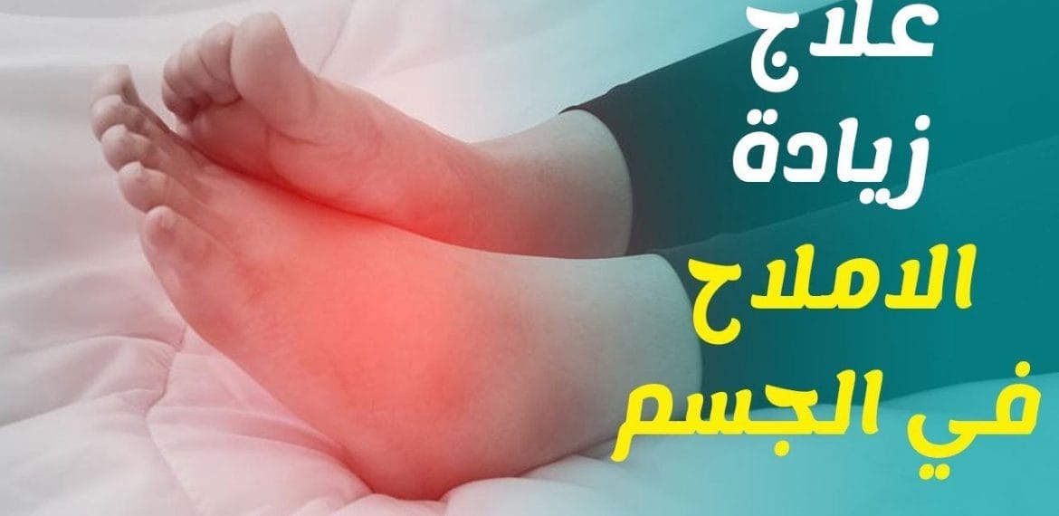 أسباب ارتفاع الأملاح في الجسم