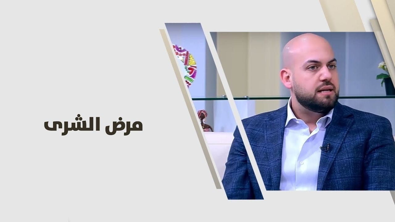 مرض الشري أو مرض الأرتيكاريا