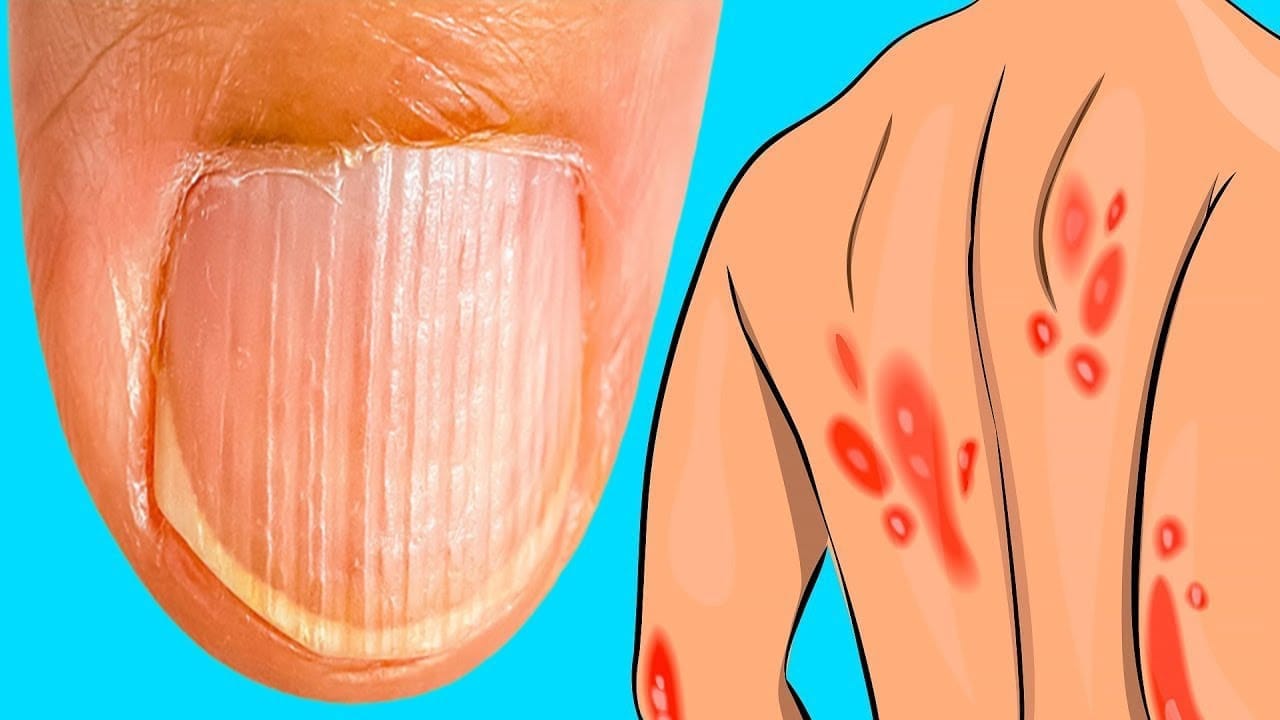 نقص المغنيسيوم في الجسم