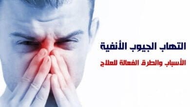 صورة علاج التهاب الجيوب الأنفية