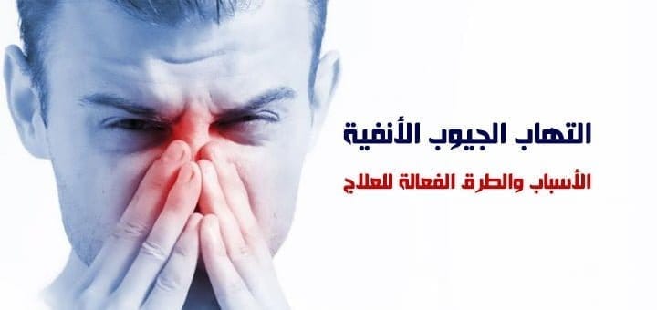 علاج التهاب الجيوب الأنفية