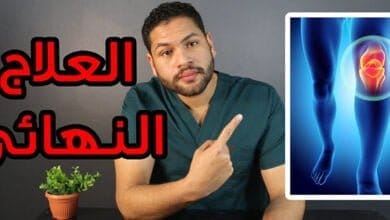 صورة كيفية علاج خشونة الركبة