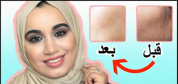 ازالة شعر الوجه الزائد بطرق طبيعية