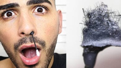 صورة طرق ازالة شعر الوجه الأكثر شيوعاً