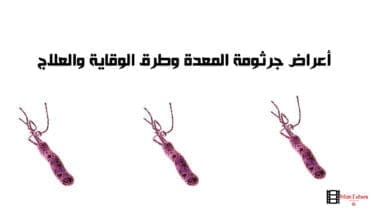 صورة أعراض جرثومة المعدة وقرحة المع وطرق الوقاية والعلاج