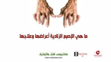 صورة ما هي الإصبع الزنادية أعراضها وعلاجها