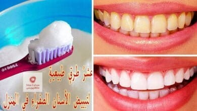 صورة طريقة لتبييض الأسنان | عشر طرق طبيعية لـ تبييض الاسنان الصفراء في المنزل
