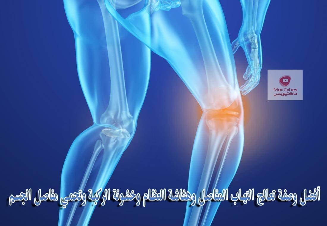 علاج التهاب المفاصل | أفضل وصفة تعالج التهاب المفاصل وهشاشة العظام وخشونة الركبة