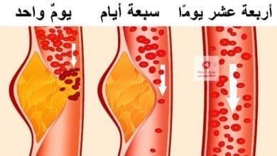 صورة حمية داش | ما هي حمية داش ولماذا يعتبرها الأطباء أحد أفضل الأنظمة الغذائية؟