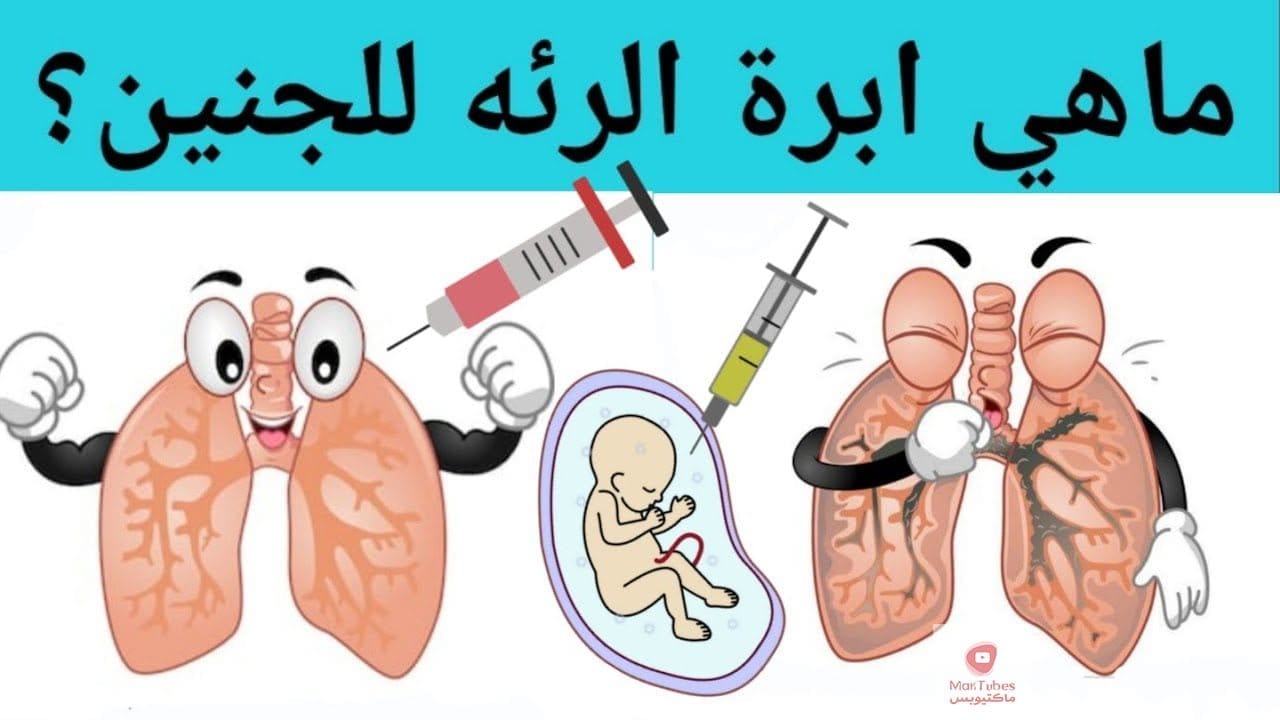 ما هي ابرة الرئة للحامل | ابرة اكتمال الرئة | ما هي ابرة الرئة للجنين