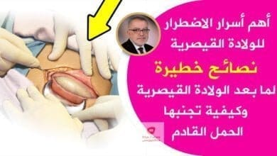 صورة العملية القيصرية | نصائح هامة في الولادة بعملية قيصرية، كيف تحمي نفسك؟