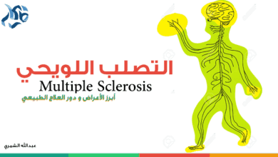 صورة التصلب اللويحي المتعدد – أعراض المرض وعلاجه – Multiple sclerosis
