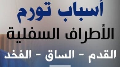 صورة اسباب تورم القدمين والاطراف السفلية – الوذمة الاستسقاء الطرفي