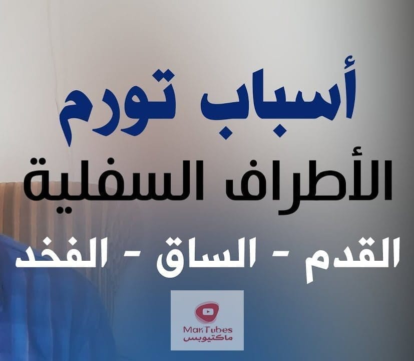 اسباب تورم القدمين والاطراف السفلية - الوذمة الاستسقاء الطرفي