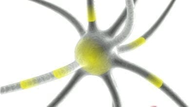 صورة النقاط الساخنة لإصلاح الحمض النووي والخرف الدماغي