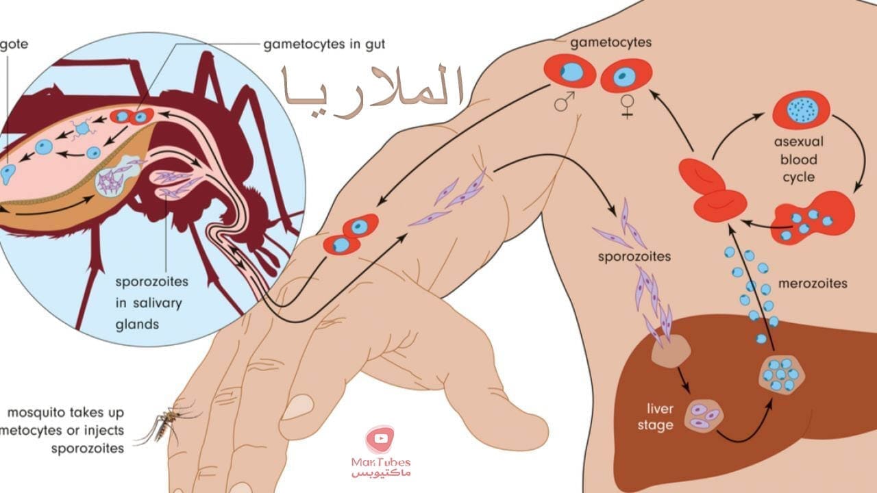 ما هي الملاريا Malaria | انواعها | اعراضها | طرق انتشارها