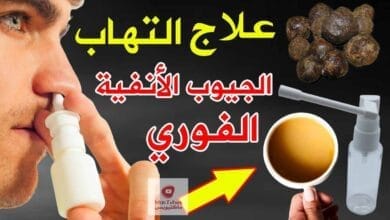 صورة الجيوب الانفية ما هو علاجها ؟ وعلاج انسداد الانف والقضاء على حساسية الانف