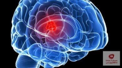 صورة لقاح سرطان الدماغ في القريب العاجل