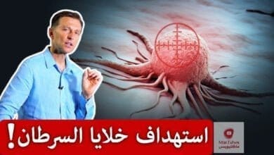 صورة الخلايا السرطانية | تناولوا هذه الخضار التي تجعل خلايا السرطان تنتحر
