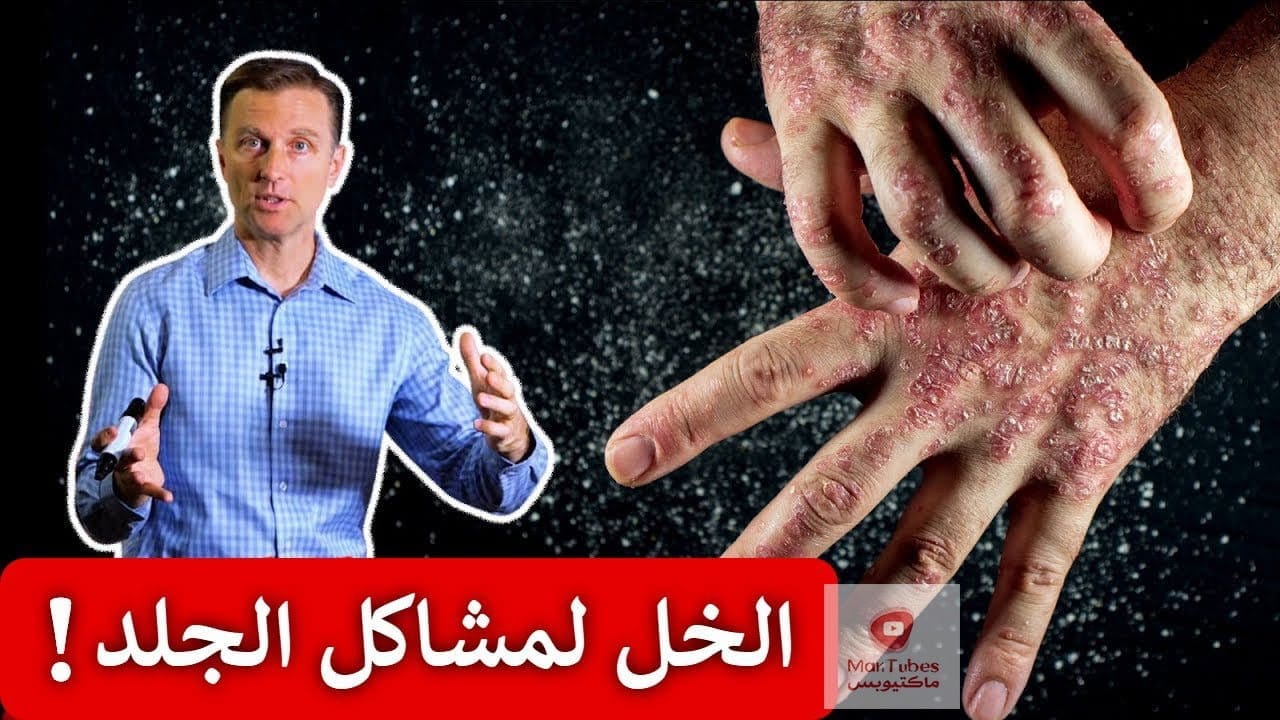 فائدة خل التفاح | استخدموا خل التفاح بهذه الطريقة لمشاكل الجلد والاكزيما